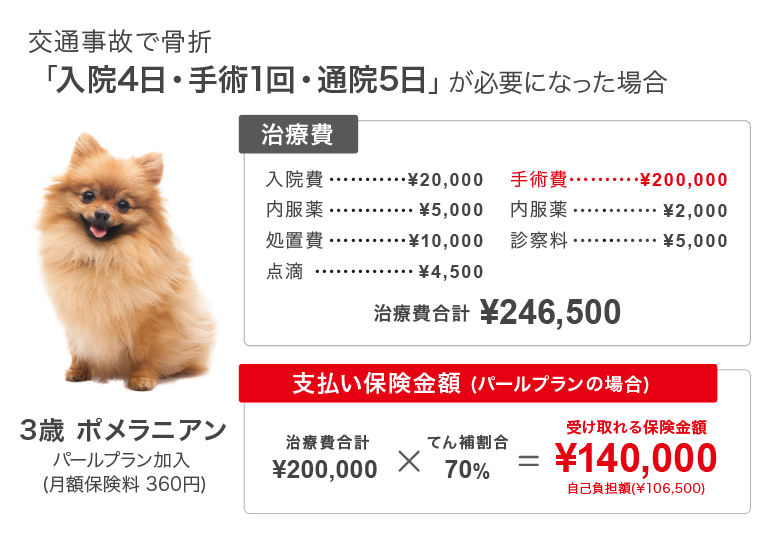 交通事故で骨折「入院4日・手術1回・通院5日」が必要になった場合